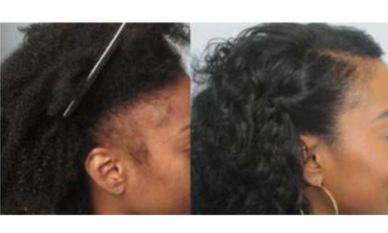 Unlock Your Hair’s True Potential Today!